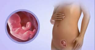 جنین در سه ماهگی چه شکلیه