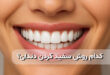 سفید کردن دندان‌ها: از بلیچینگ تا لمینت سرامیکی و کامپوزیت ونیر